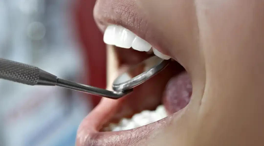 Zašto redovni stomatološki pregledi mogu spriječiti ozbiljnije probleme