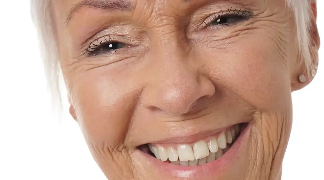 Zubni implantati kod starijih osoba – sve što trebate znati