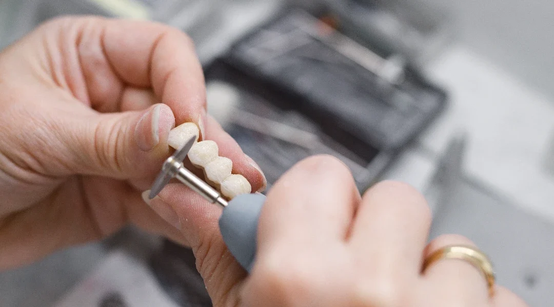 Most i gingiva: oblik pontika i utjecaj na upalu, zadah i čišćenje